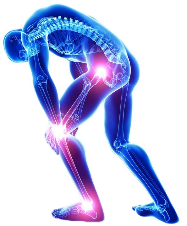 Akútna bolesť pri pohybe je príznakom ochorenia kĺbov