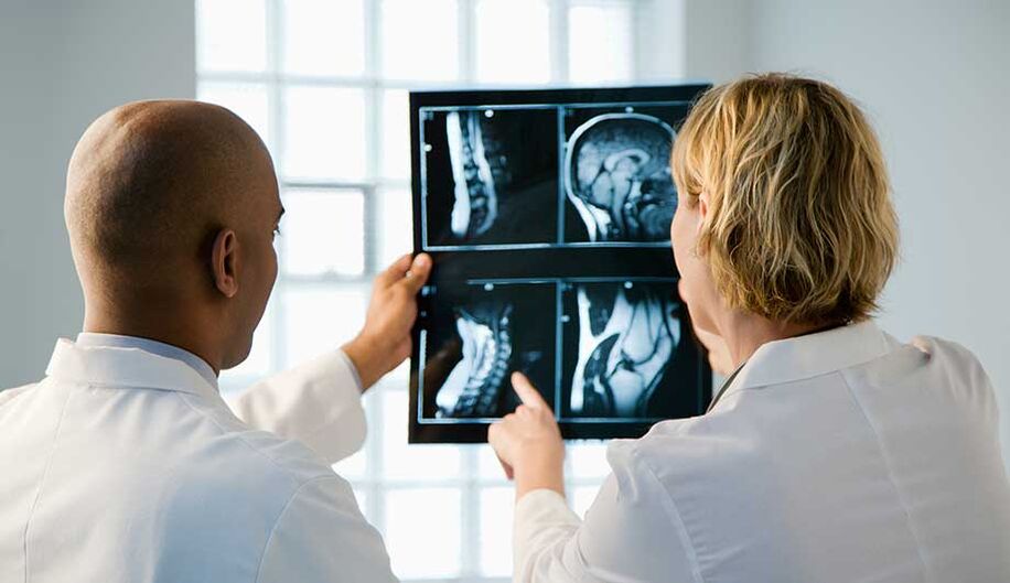 diagnostika cervikálnej osteochondrózy obrázkami