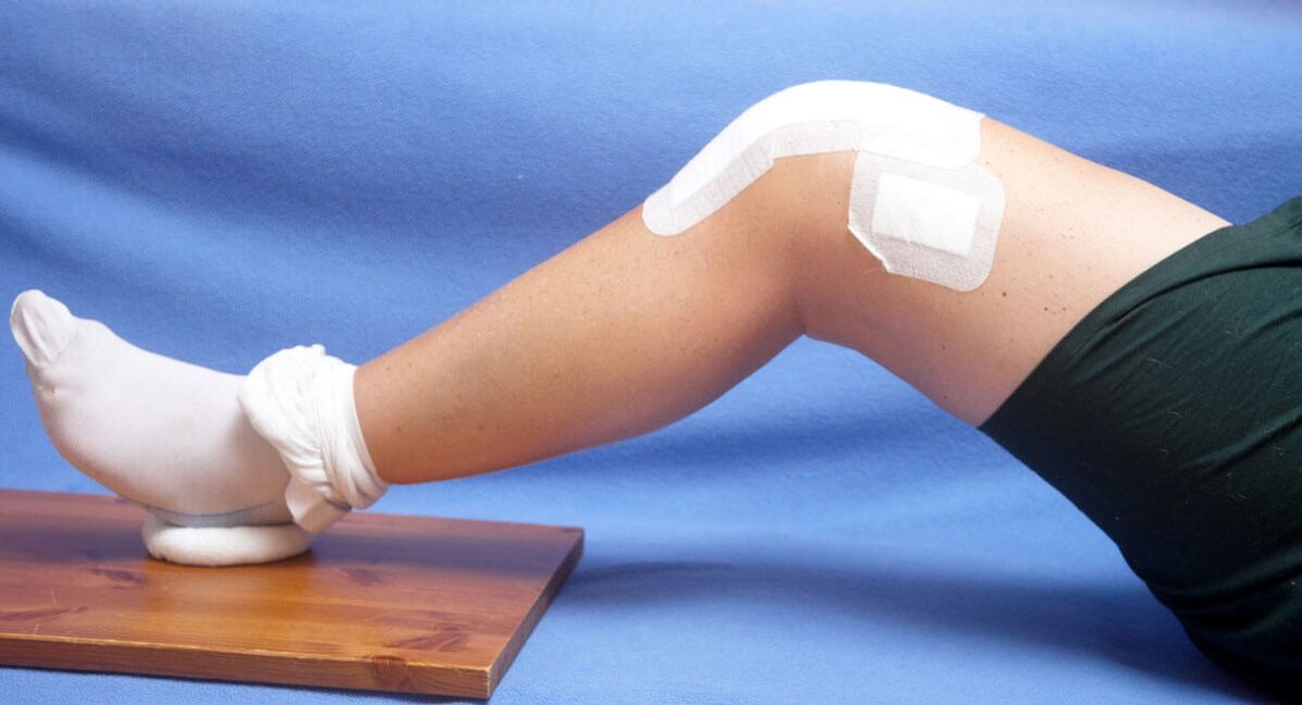 poranenie kolena ako príčina artrózy