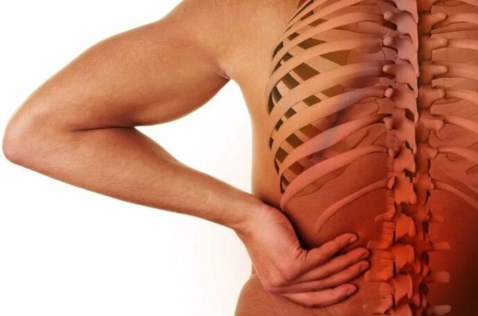 Bedrová osteochondróza