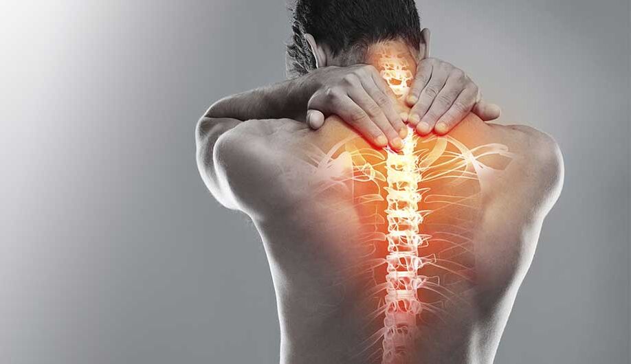 Osteochondróza krku