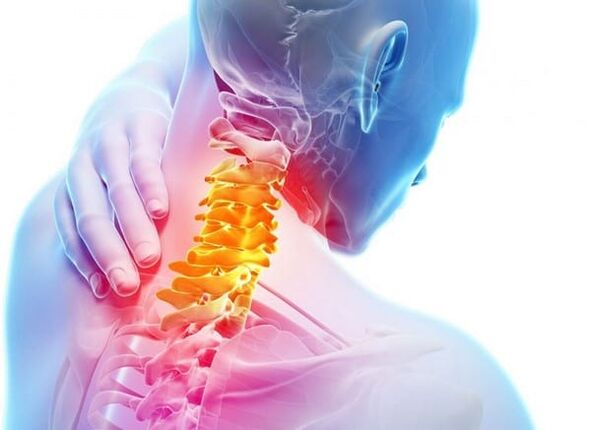 Osteochondróza krčnej chrbtice