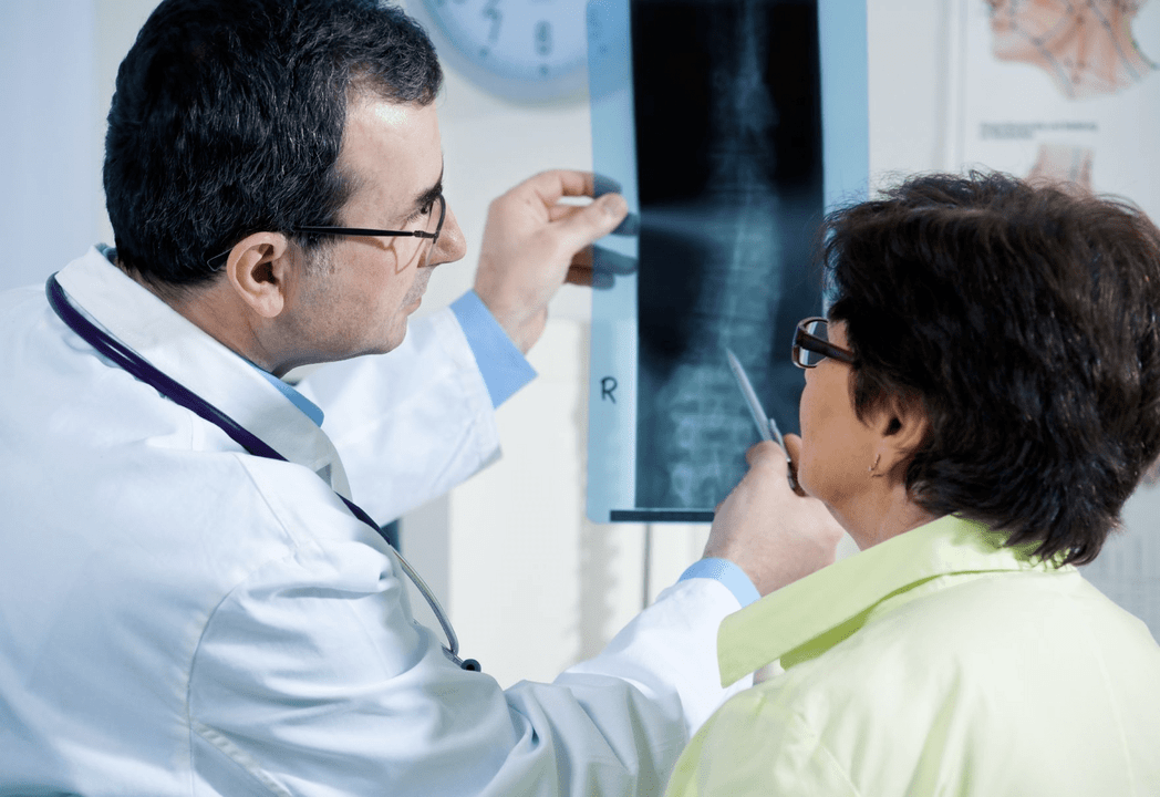 Neurológ diagnostikuje osteochondrózu pomocou rádiografie chrbtice