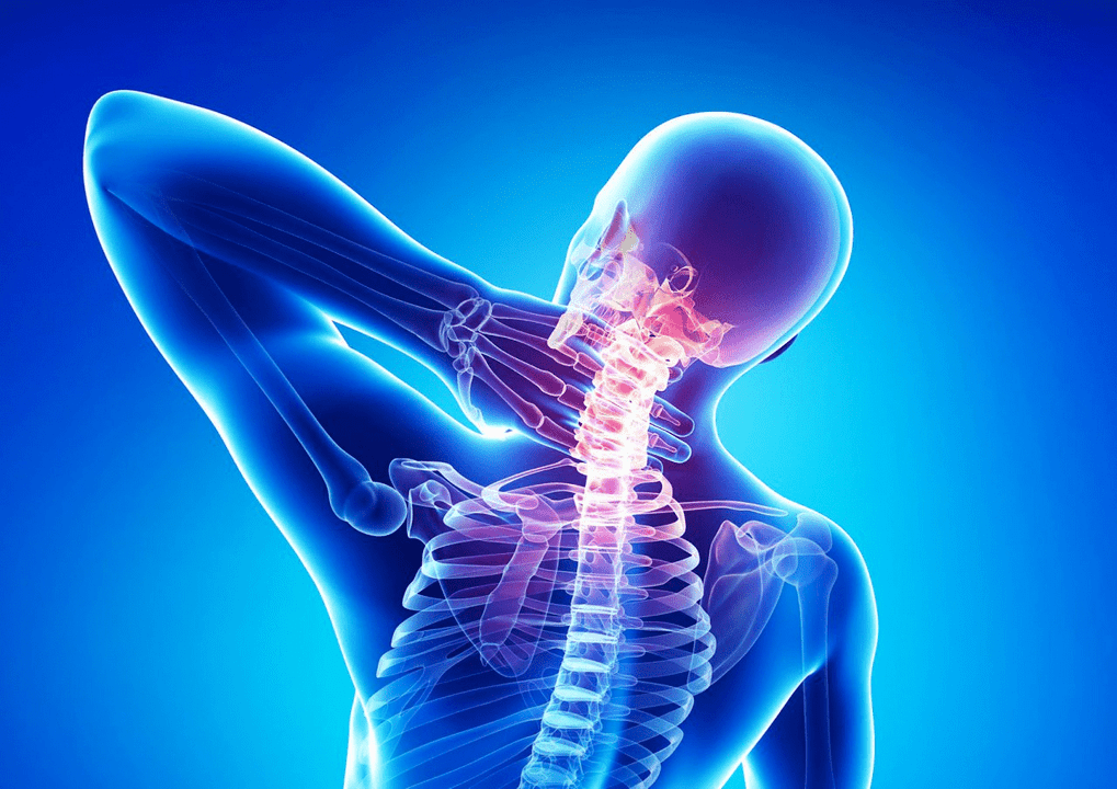 Osteochondróza chrbtice
